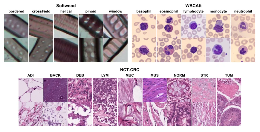 Microscopy examples from softwood anatomy, white blood cells, and colorectal tissue datasets.